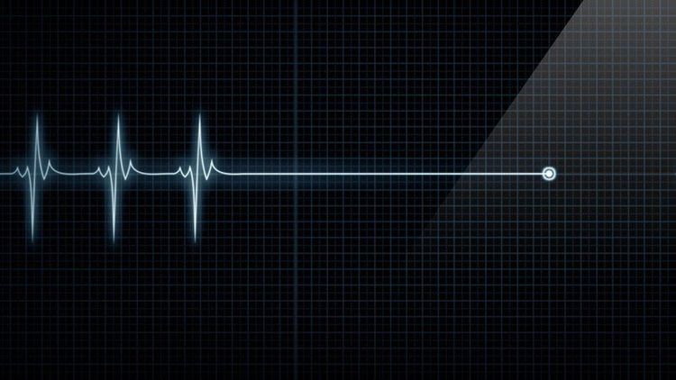 Bệnh nhân có thể bị ngừng tim khi gây mê nội khí quản trong mổ nội soi u nang buồng trứng.