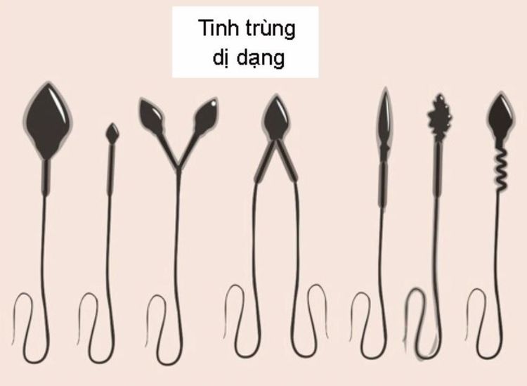 
Một số kiểu dị dạng tinh trùng thường gặp
