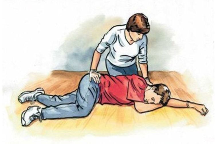 Sơ cứu bệnh nhân đột quỵ bằng cách đặt bệnh nhân nằm nghiêng đầu