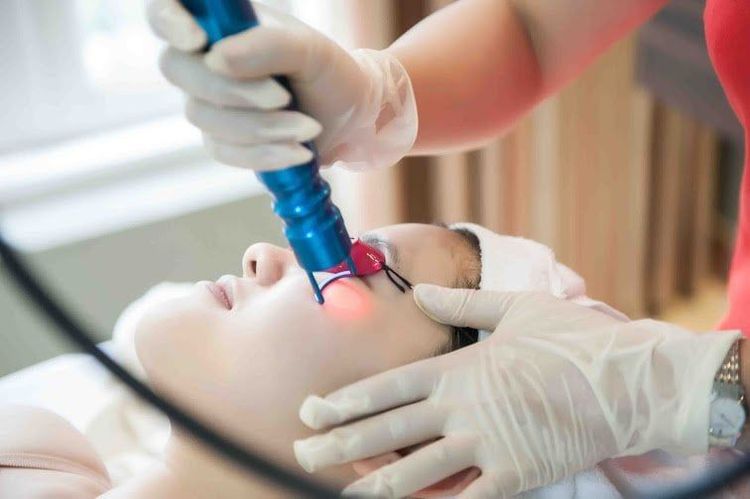 
Điều trị bằng laser (laser treatment) được sử dụng trong điều trị nám da
