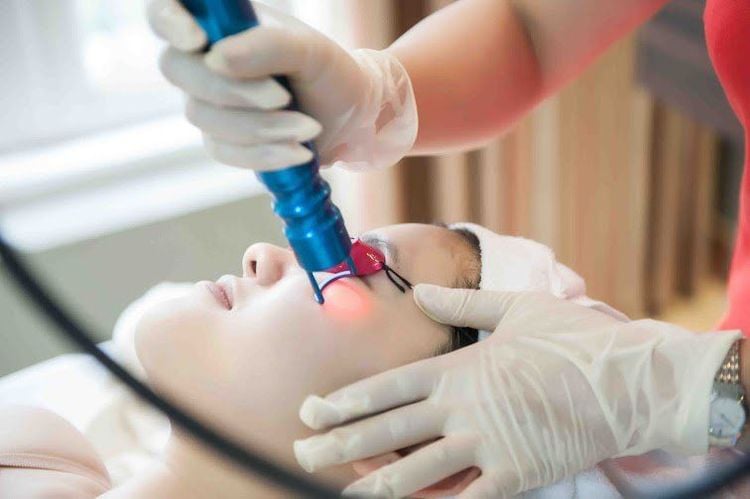 
Liệu pháp laser là một cách làm giảm melanin trong da
