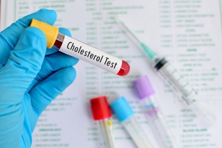 
Cholesterol toàn phần bao gồm tổng HDL, LDL và VLDL
