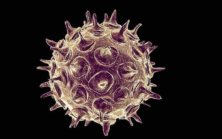 
Virus Varicella-zoster là tác nhân gây bệnh hai bệnh cảnh là thủy đậu (varicella) và bệnh zona (zoster)
