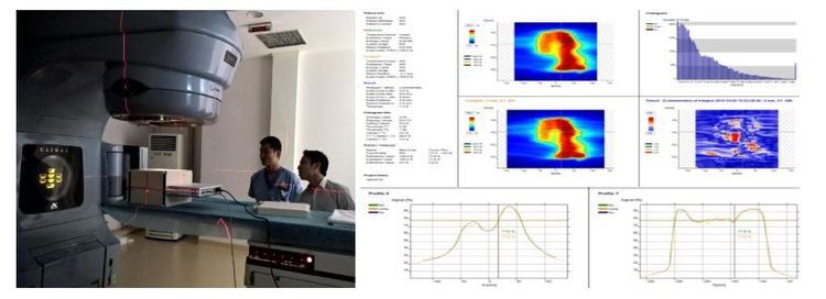 
Hình 3. Chiếu xạ kế hoạch lên phantom và đo liều thực tế so với liều tính toán trên kế hoạch để kiểm tra chất lượng kế hoạch trước xạ trị.
