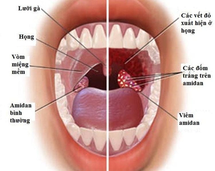 
Hình ảnh giải phẫu cổ họng
