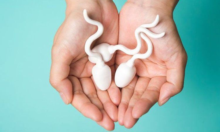 Effect of temperature on sperm motility and viability