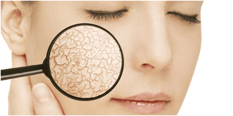 Any skin type can increase melanin to reduce the risk of skin cancer