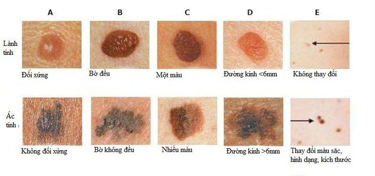 
Cà chua có vai trò ngăn ngừa bệnh ung thư da
