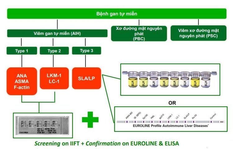 Xét nghiệm định danh 14 tự kháng thể trong bệnh gan tự miễn