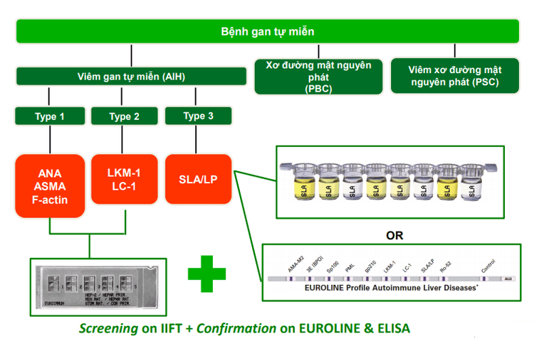 Test to identify 14 autoantibodies in autoimmune liver disease