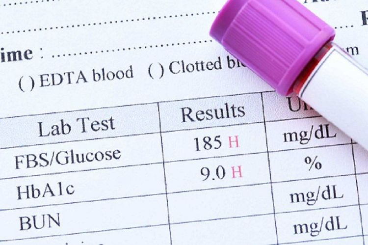 
Chỉ số HbA1c trong xét nghiệm tiền đái tháo đường
