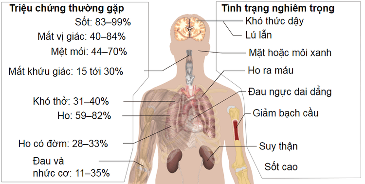 Ứng dụng tế bào gốc trung mô trong điều trị COVID-19