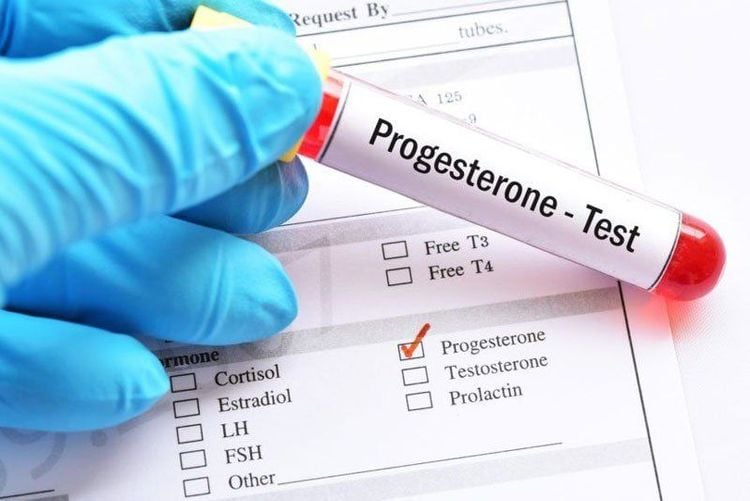 
Xét nghiệm progesterone khi mang thai có thể chẩn đoán thai ngoài tử cung vỡ và thai trong tử cung
