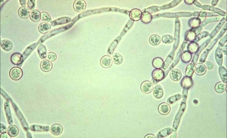 
Nấm candida là nguyên nhân gây nhiễm trùng nấm da mặt
