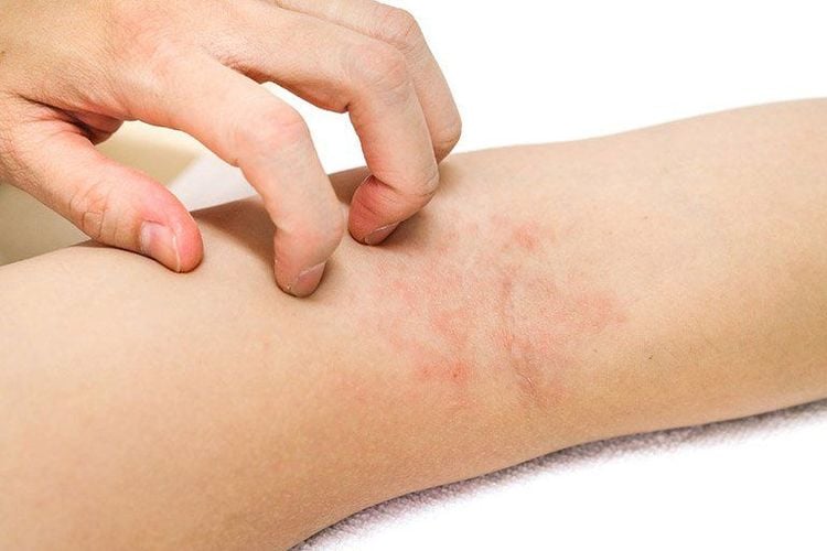 
Bệnh Sarcoidosis có thể khó chẩn đoán
