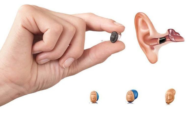 
How to choose the right type of hearing aid?
