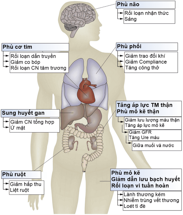 
Hình 1: Tác hại của quá tải dịch “Nguồn: O'Connor 2015” [37]
