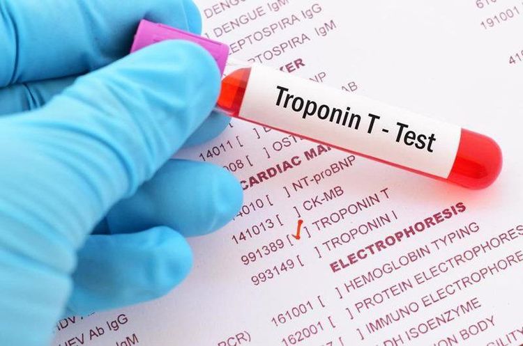 
Troponin trong máu tăng phản ánh tình trạng hoại tử cơ tim, nhưng không phải luôn luôn là do nhồi máu cơ tim
