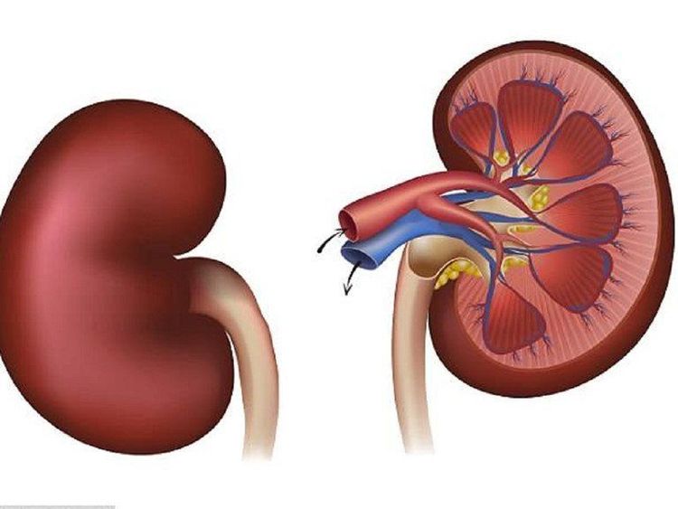 Một dấu hiệu của hoại tử ống thận cấp gây khó tiểu