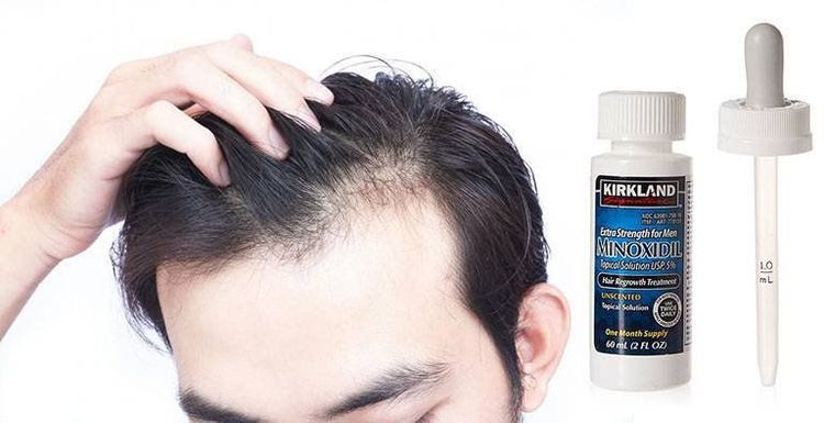 
Bôi dung dịch minoxidil trực tiếp lên da đầu có thể kích thích mọc tóc
