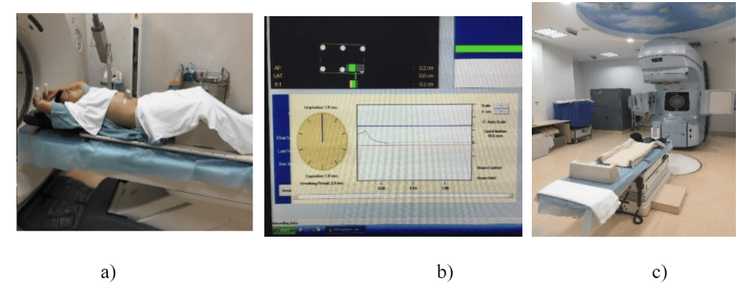 
Hình 1: Đặt tư thế cố định bệnh nhân trong chụp CT (a), Tín hiệu nhịn thở của hệ thống RPM (b) và Bộ dụng cụ cố định của bệnh nhân (c).
