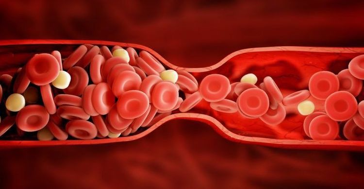 
Bệnh nhân bị rối loạn đông máu cần tham khảo ý kiến bác sĩ trước khi dùng thuốc Etonogestrel
