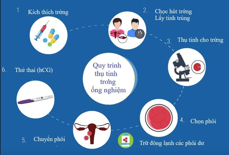 
Quá trình thực hiện thụ tinh ống nghiệm
