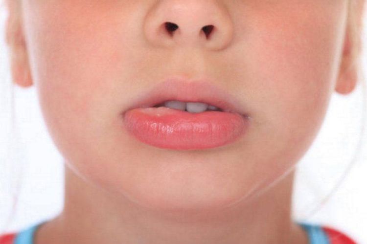 Allergies to certain medications can also cause swollen lips after waking up.
