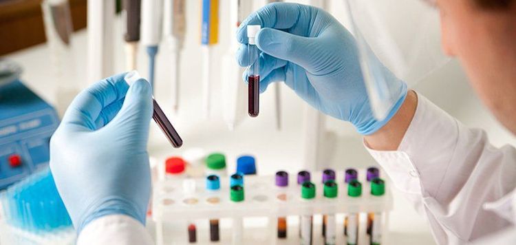 Thuốc Zutripro có thể ảnh hưởng đến một số xét nghiệm y tế