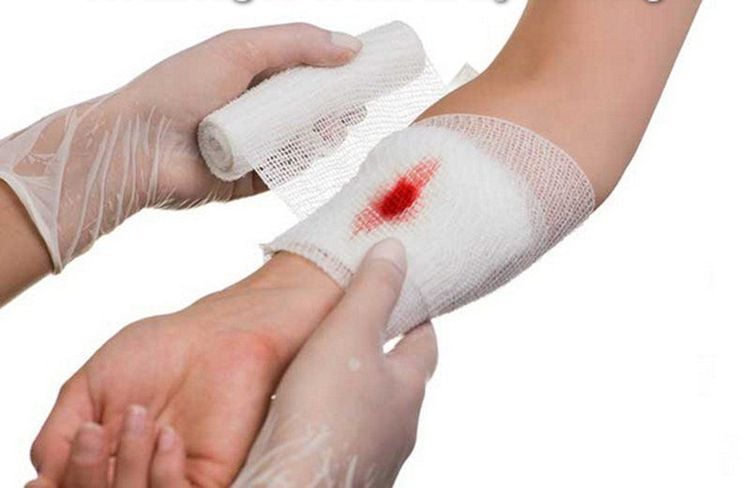 If you have an open wound, you should supplement with foods high in protein to recover quickly