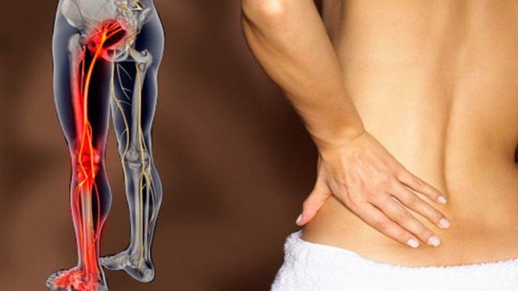 Đau thần kinh gây ra bởi một tổn thương ban đầu hoặc rối loạn chức năng hệ thần kinh