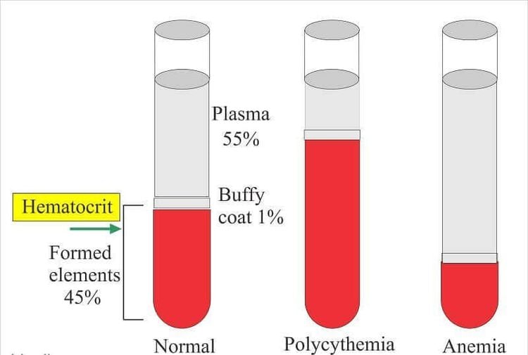 
Xét nghiệm Hematocrit nhằm chẩn đoán các rối loạn về máu
