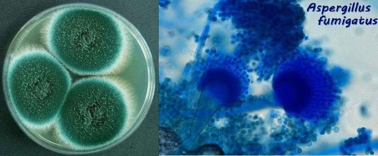 
Hình ảnh khuẩn lạc nấm Aspergillus fumigatus và hình ảnh nấm Aspergillus fumigatus dưới kính hiển vi
