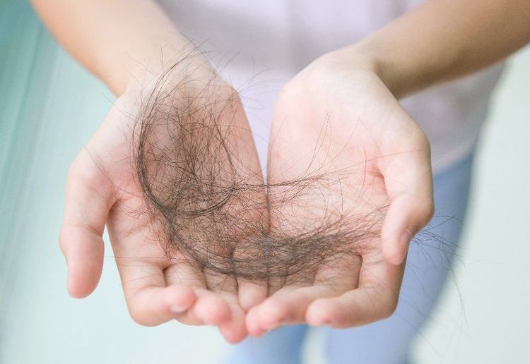 Losing a lot of hair, feeling dizzy when standing up is anemia?