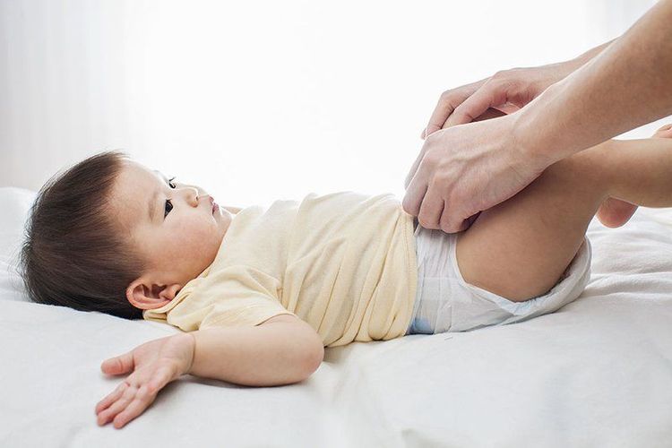 What is the cause of bulging veins around the anus when the child has a bowel movement?