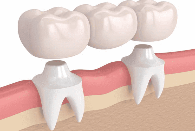 
Khi bị mất răng số 7 sẽ không mọc lại nữa
