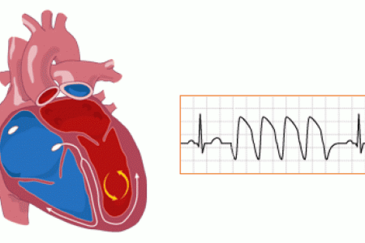 How are women treated with ventricular extrasystoles?