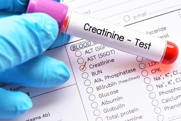 Chỉ số Creatinin 50 mmol/l ở nữ giới có bình thường không?