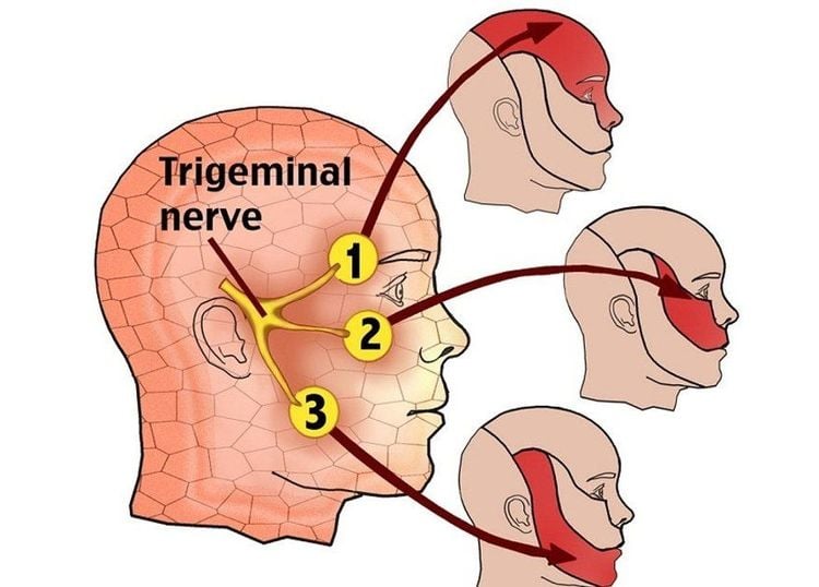 
Bấm huyệt chữa thần kinh ngoại biên có thể hỗ trợ điều trị đau dây thần kinh số 5.
