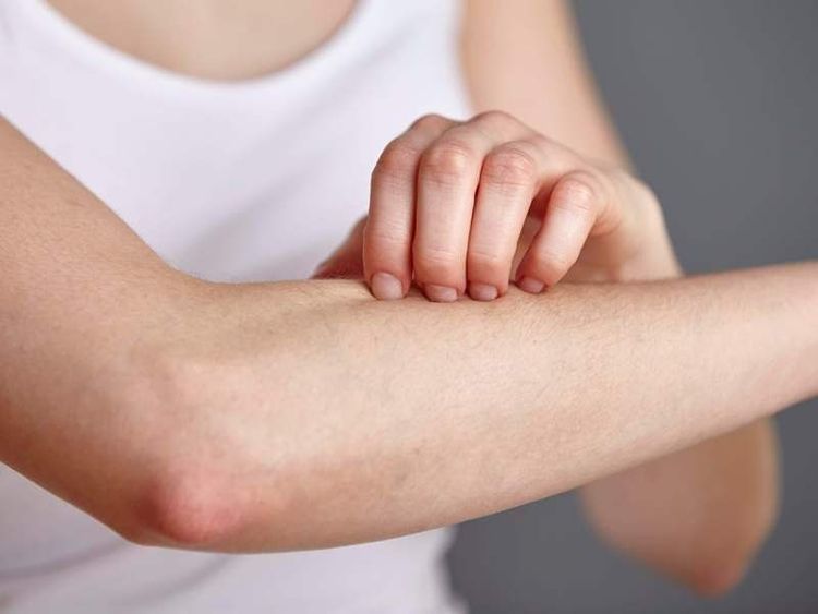 Calcium deficiency may cause itchy skin in patients