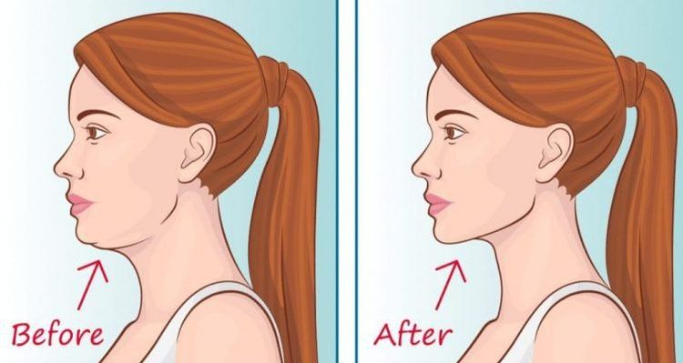 Mewing is an effective technique for enhancing facial aesthetics.