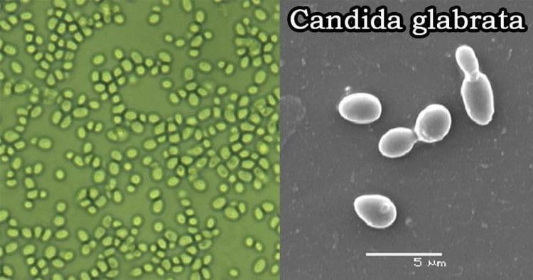 Hình ảnh nấm Candida soi tươi