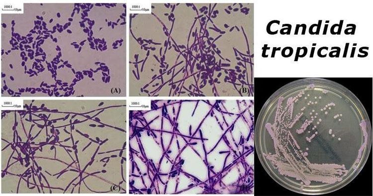 
Hình ảnh tế bào nấm Candida Tropicalis và sợi tơ nấm (nhuộm Gram)
