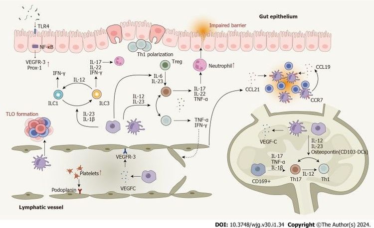 Mô hình bệnh sinh bệnh Crohn cho thấy tác động bệnh lý của hệ thống bạch huyết trong bệnh Crohn 