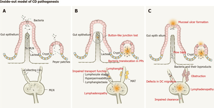 Mô hình bên trong ra ngoài về quá trình sinh bệnh của bệnh Crohn