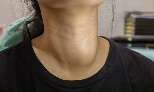 Gently remove thyroid nodules, without surgery