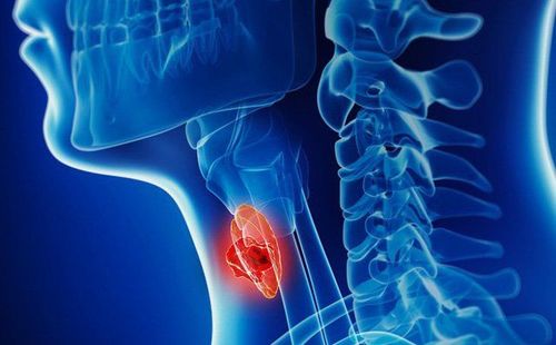 Stages and progression of throat cancer