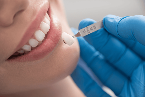 How does the dental crown process work?