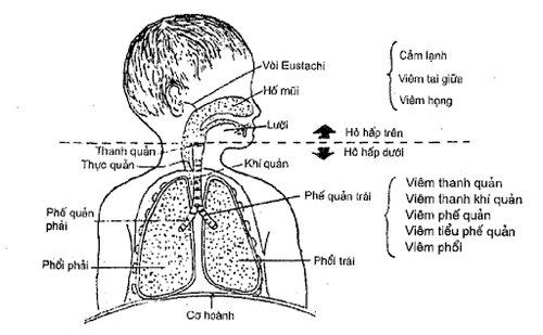 Guidelines for caring for children with bronchitis