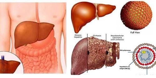 Is cirrhosis of the liver contagious?